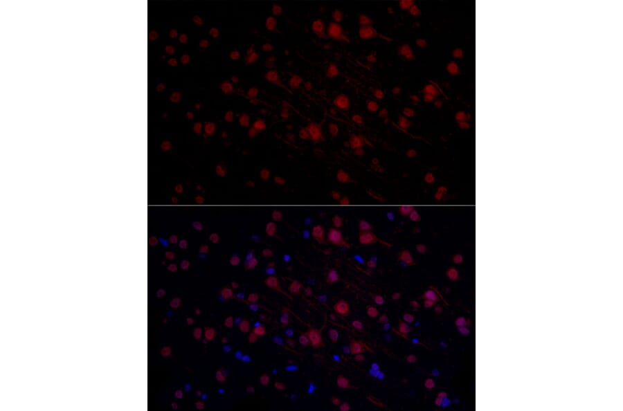 Immunofluorescence - Anti-n-Myc/MYCN Antibody (A12638) - Antibodies.com