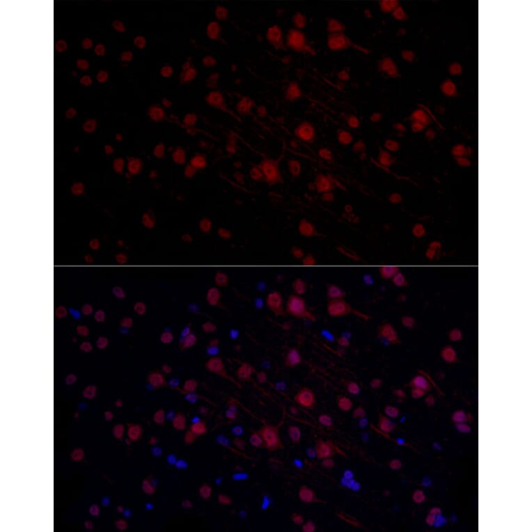 Immunofluorescence - Anti-n-Myc/MYCN Antibody (A12638) - Antibodies.com