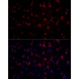 Immunofluorescence - Anti-n-Myc/MYCN Antibody (A12638) - Antibodies.com