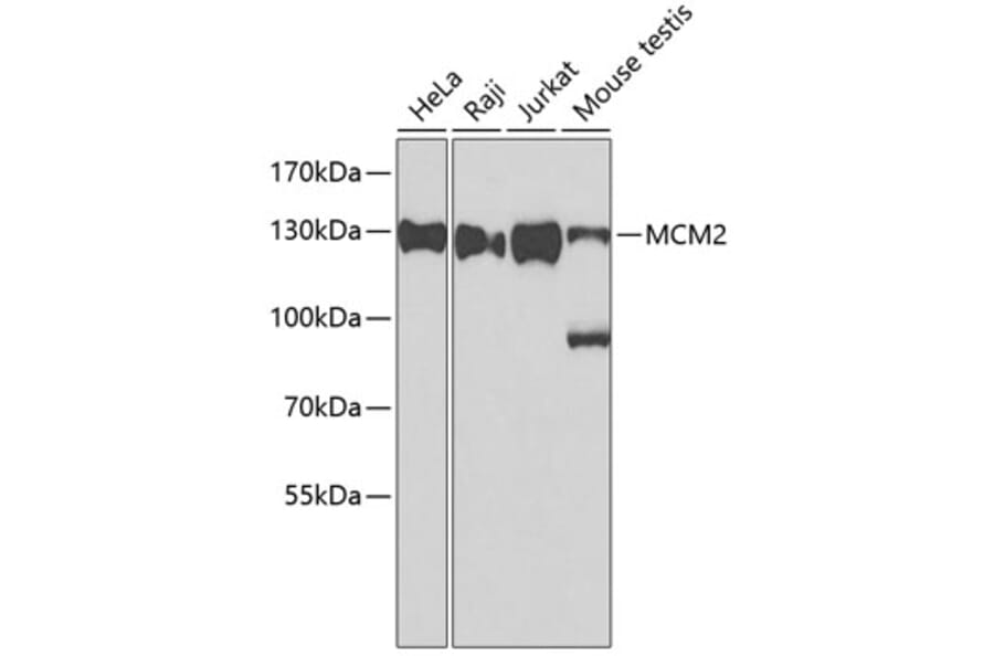 Western Blot - Anti-MCM2 Antibody (A0502) - Antibodies.com
