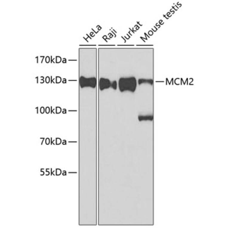 Western Blot - Anti-MCM2 Antibody (A0502) - Antibodies.com