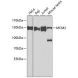 Western Blot - Anti-MCM2 Antibody (A0502) - Antibodies.com