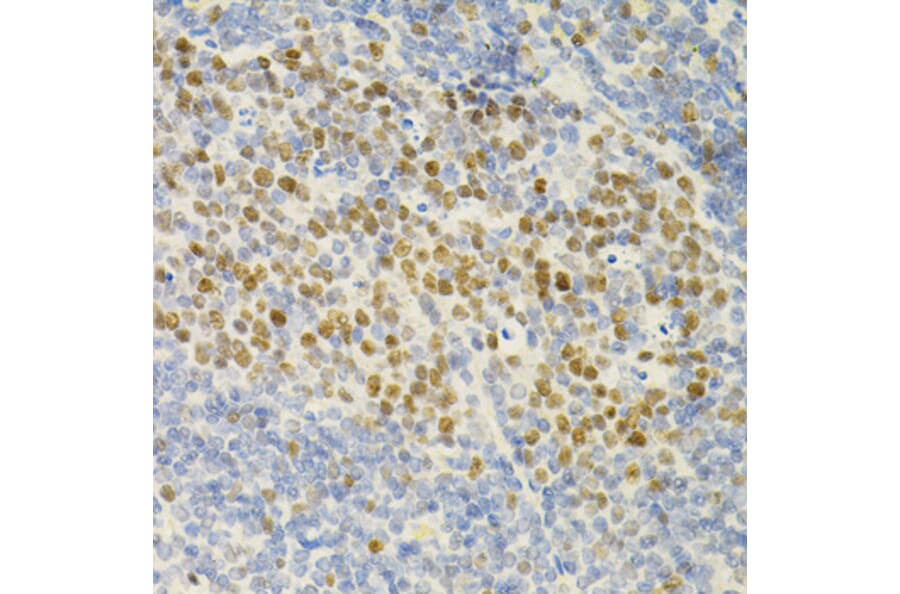 Immunohistochemistry - Anti-MCM2 Antibody (A0502) - Antibodies.com