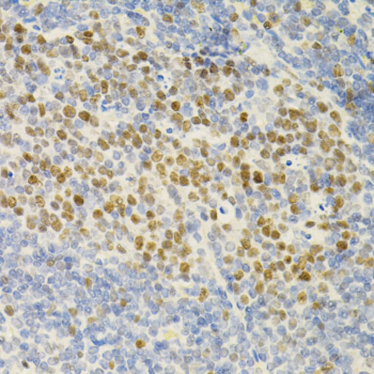 Immunohistochemistry - Anti-MCM2 Antibody (A0502) - Antibodies.com