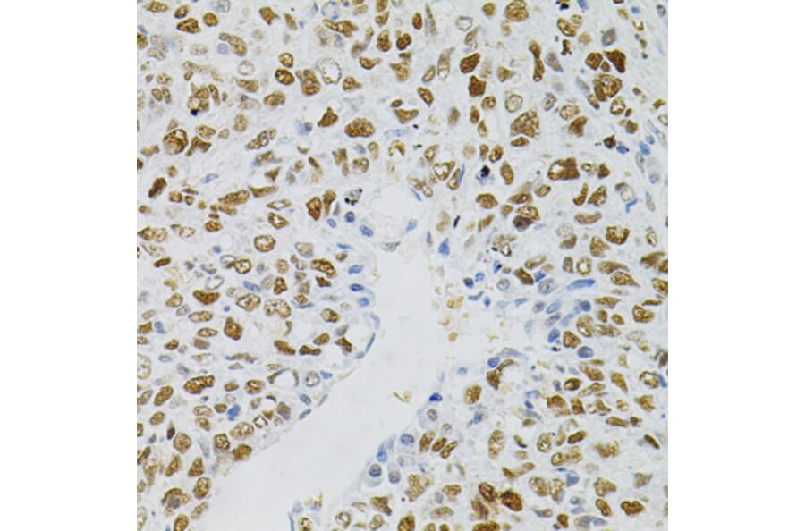 Immunohistochemistry - Anti-MCM2 Antibody (A0502) - Antibodies.com