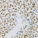 Immunohistochemistry - Anti-MCM2 Antibody (A0502) - Antibodies.com