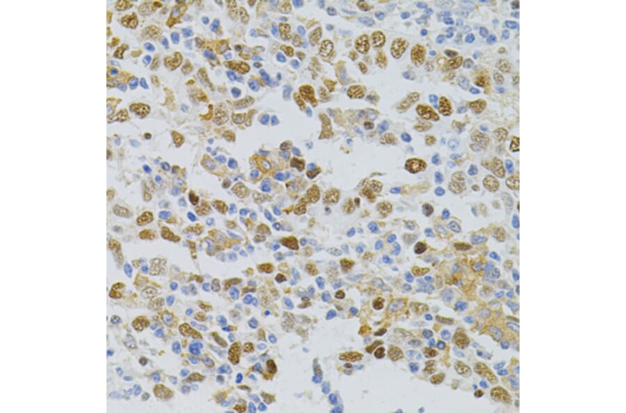 Immunohistochemistry - Anti-MCM2 Antibody (A0502) - Antibodies.com