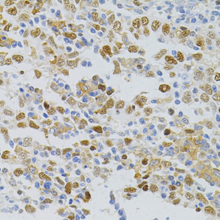 Immunohistochemistry - Anti-MCM2 Antibody (A0502) - Antibodies.com
