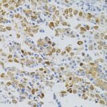 Immunohistochemistry - Anti-MCM2 Antibody (A0502) - Antibodies.com