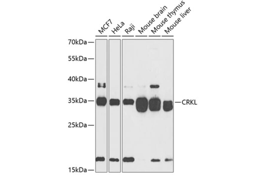 Western Blot - Anti-CrkL Antibody (A12640) - Antibodies.com