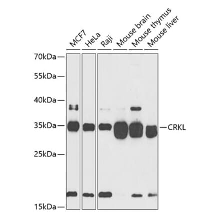 Western Blot - Anti-CrkL Antibody (A12640) - Antibodies.com