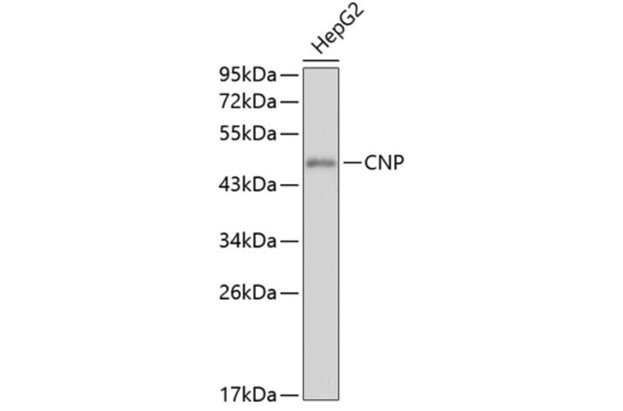 Western Blot - Anti-CNP Antibody (A0517) - Antibodies.com