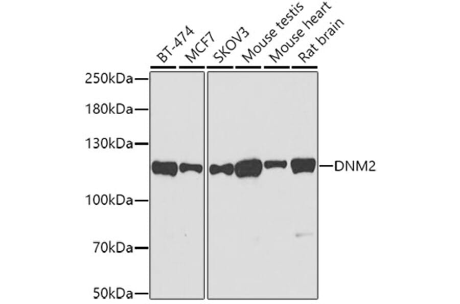 Western Blot - Anti-Dynamin 2 Antibody (A12643) - Antibodies.com
