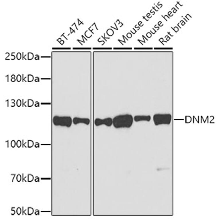 Western Blot - Anti-Dynamin 2 Antibody (A12643) - Antibodies.com