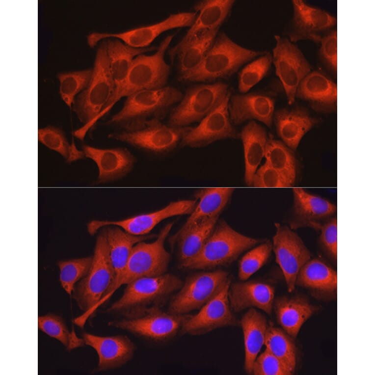 Immunofluorescence - Anti-Dynamin 2 Antibody (A12643) - Antibodies.com