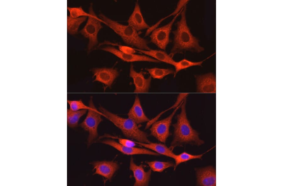 Immunofluorescence - Anti-Dynamin 2 Antibody (A12643) - Antibodies.com