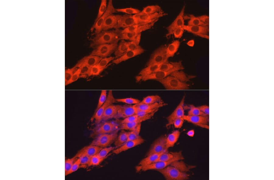 Immunofluorescence - Anti-Dynamin 2 Antibody (A12643) - Antibodies.com