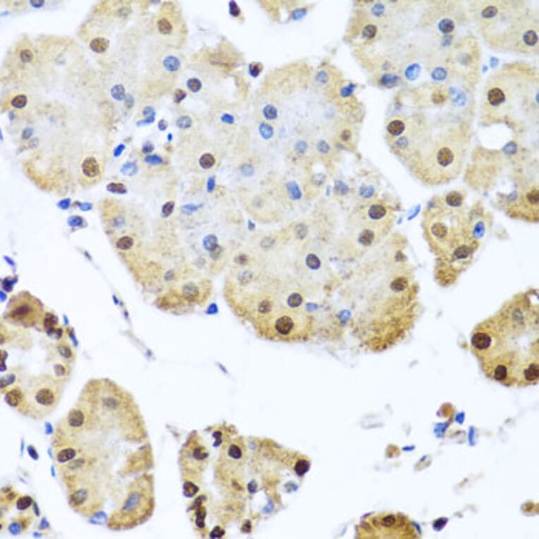 Immunohistochemistry - Anti-NuMA Antibody (A12645) - Antibodies.com