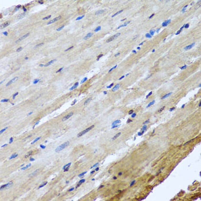 Immunohistochemistry - Anti-NuMA Antibody (A12645) - Antibodies.com