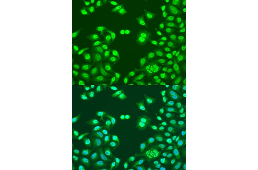 Immunofluorescence - Anti-NuMA Antibody (A12645) - Antibodies.com