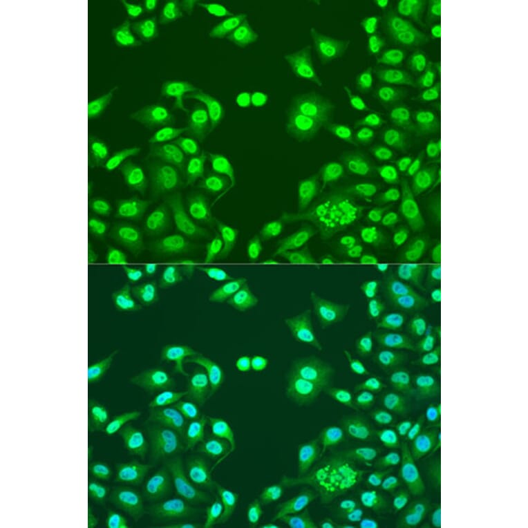 Immunofluorescence - Anti-NuMA Antibody (A12645) - Antibodies.com