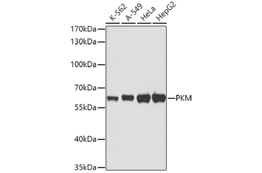 Western Blot - Anti-PKM Antibody (A0540) - Antibodies.com