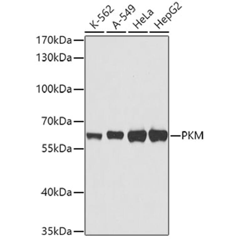 Western Blot - Anti-PKM Antibody (A0540) - Antibodies.com