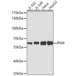 Western Blot - Anti-PKM Antibody (A0540) - Antibodies.com