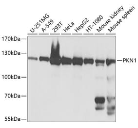Western Blot - Anti-PKN1 Antibody (A12648) - Antibodies.com