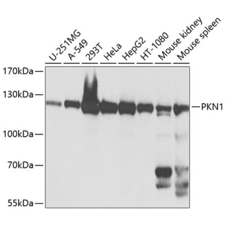 Western Blot - Anti-PKN1 Antibody (A12648) - Antibodies.com