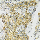 Immunohistochemistry - Anti-Grp75/MOT Antibody (A12650) - Antibodies.com