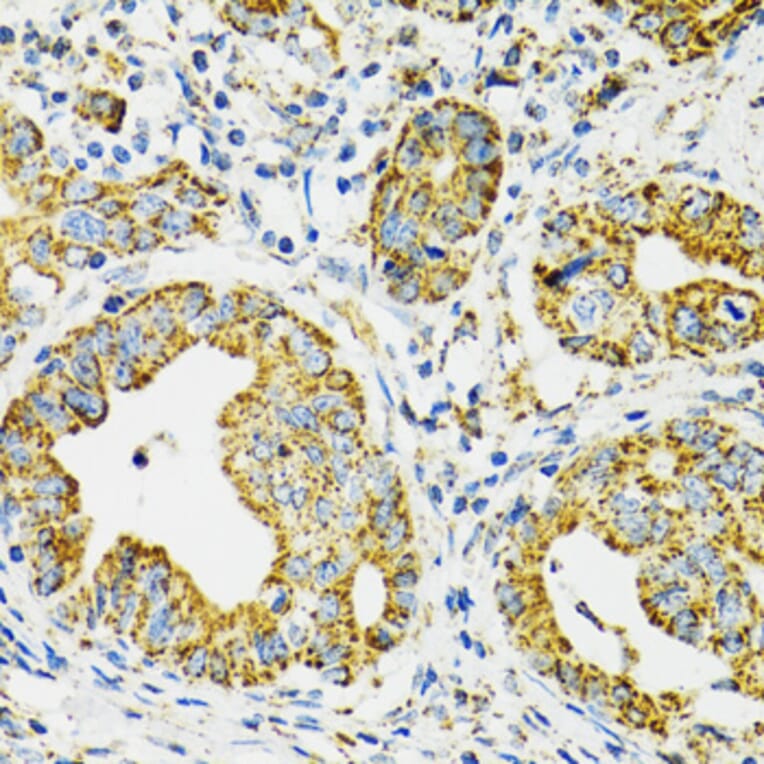 Immunohistochemistry - Anti-Grp75/MOT Antibody (A12650) - Antibodies.com