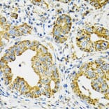 Immunohistochemistry - Anti-Grp75/MOT Antibody (A12650) - Antibodies.com