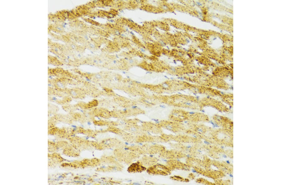 Immunohistochemistry - Anti-Grp75/MOT Antibody (A12650) - Antibodies.com