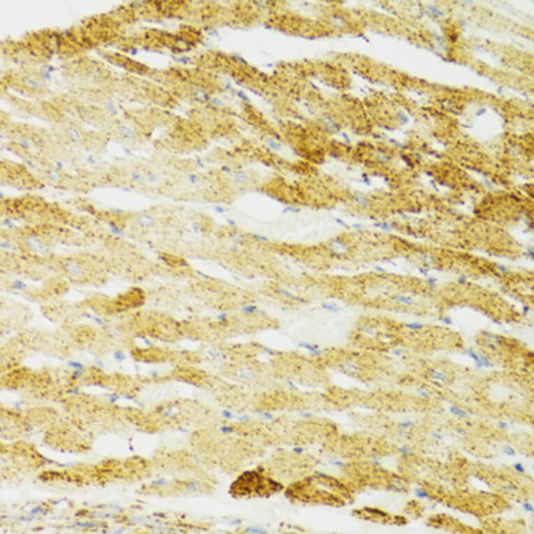 Immunohistochemistry - Anti-Grp75/MOT Antibody (A12650) - Antibodies.com