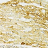 Immunohistochemistry - Anti-Grp75/MOT Antibody (A12650) - Antibodies.com