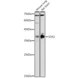 Western Blot - Anti-SOX2 Antibody (A12651) - Antibodies.com