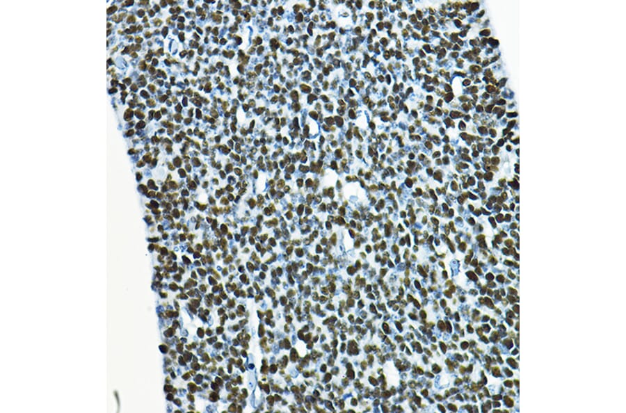 Immunohistochemistry - Anti-SOX2 Antibody (A12651) - Antibodies.com