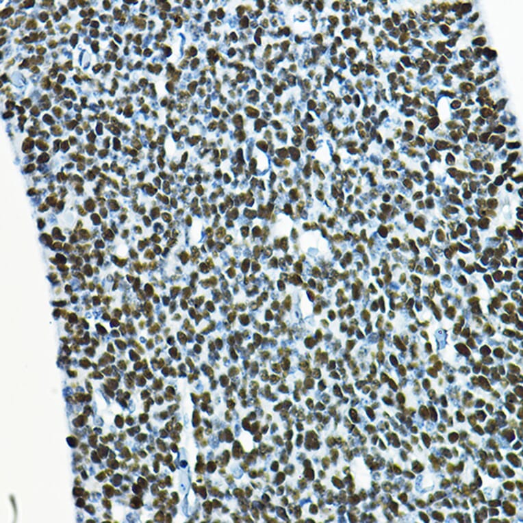 Immunohistochemistry - Anti-SOX2 Antibody (A12651) - Antibodies.com