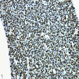Immunohistochemistry - Anti-SOX2 Antibody (A12651) - Antibodies.com