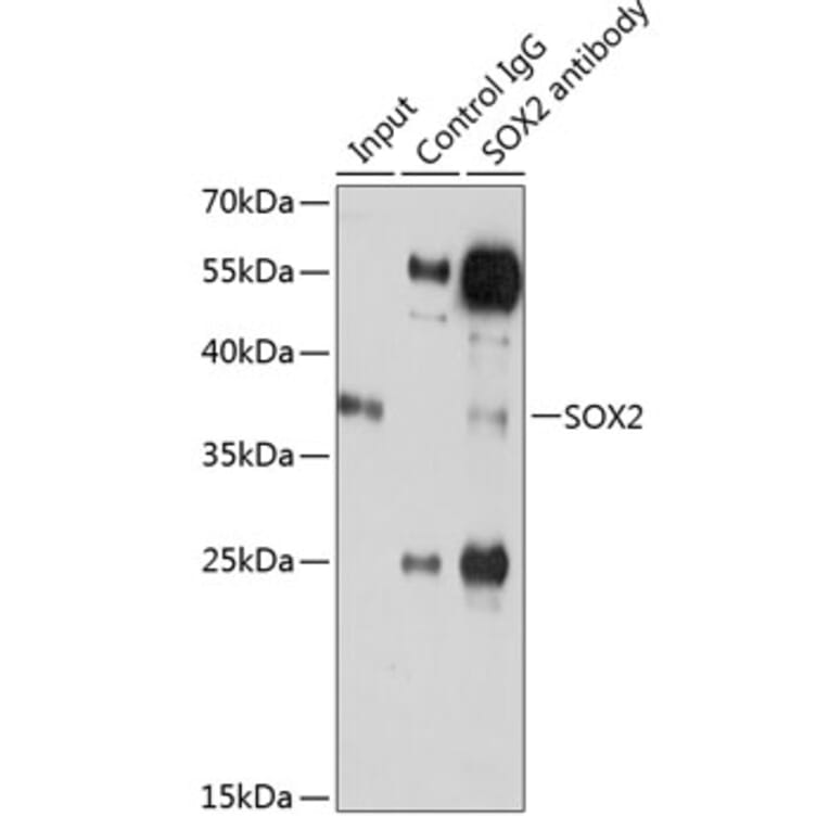 Western Blot - Anti-SOX2 Antibody (A12651) - Antibodies.com