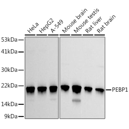 Western Blot - Anti-RKIP Antibody (A12655) - Antibodies.com