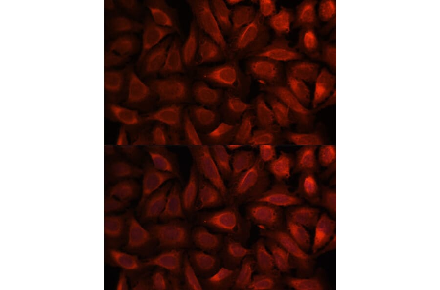 Immunofluorescence - Anti-RKIP Antibody (A12655) - Antibodies.com