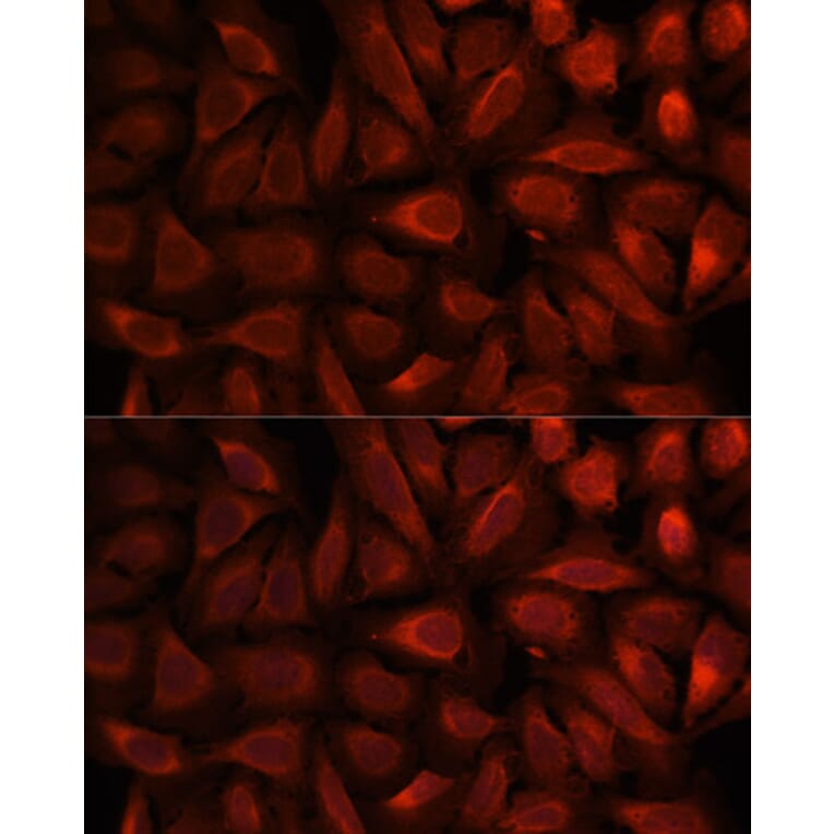 Immunofluorescence - Anti-RKIP Antibody (A12655) - Antibodies.com
