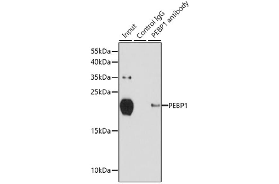 Western Blot - Anti-RKIP Antibody (A12655) - Antibodies.com