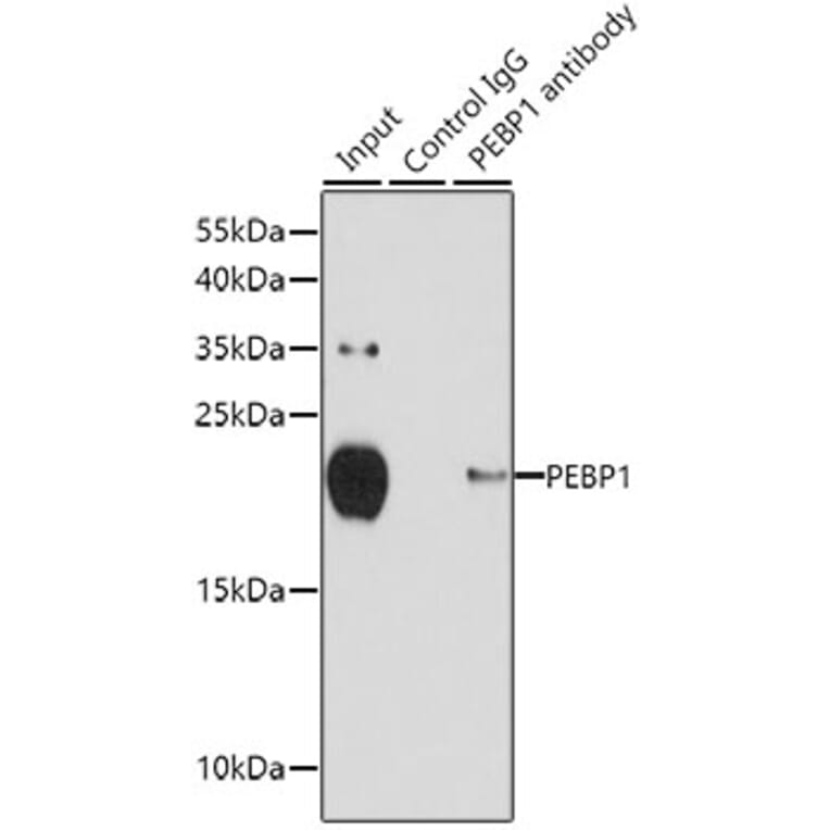Western Blot - Anti-RKIP Antibody (A12655) - Antibodies.com