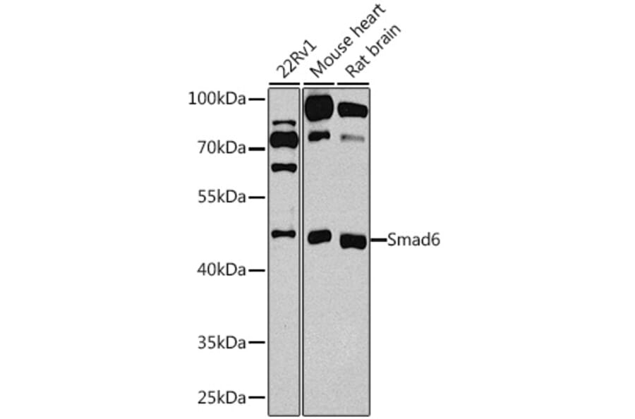 Western Blot - Anti-SMAD6 Antibody (A12656) - Antibodies.com