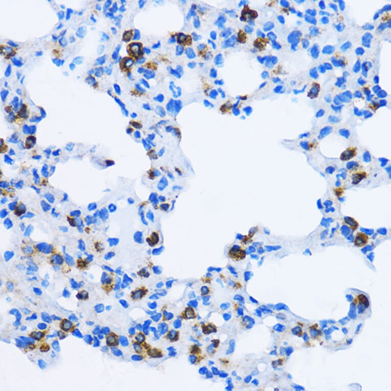Immunohistochemistry - Anti-EEA1 Antibody (A12659) - Antibodies.com