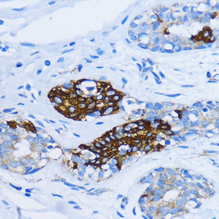 Immunohistochemistry - Anti-EEA1 Antibody (A12659) - Antibodies.com