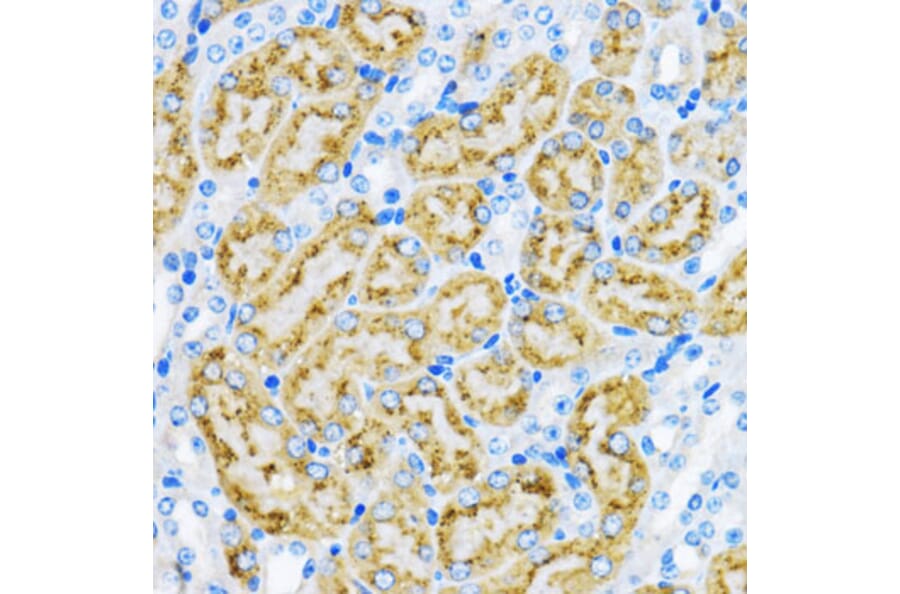 Immunohistochemistry - Anti-EEA1 Antibody (A12659) - Antibodies.com